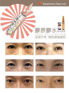 Eye Collagen Treatment Product Page / Medical Spa