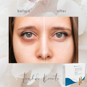 Eye Collagen Treatment Page / Medical Spa