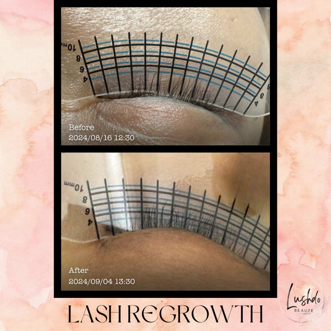 Lash Regrowth Product Page ($580)