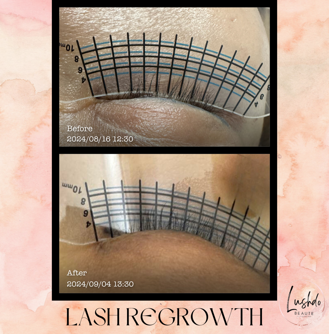 Lash Regrowth Product Page ($580)